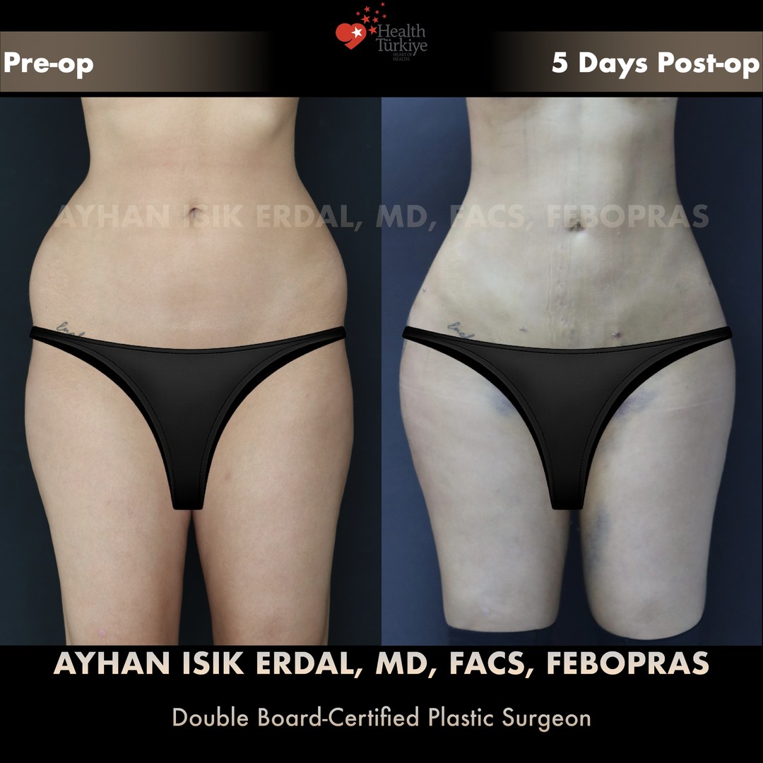 Patient case 1, view 1 — pre-op vs post-op comparison, watermarked with surgeon credentials