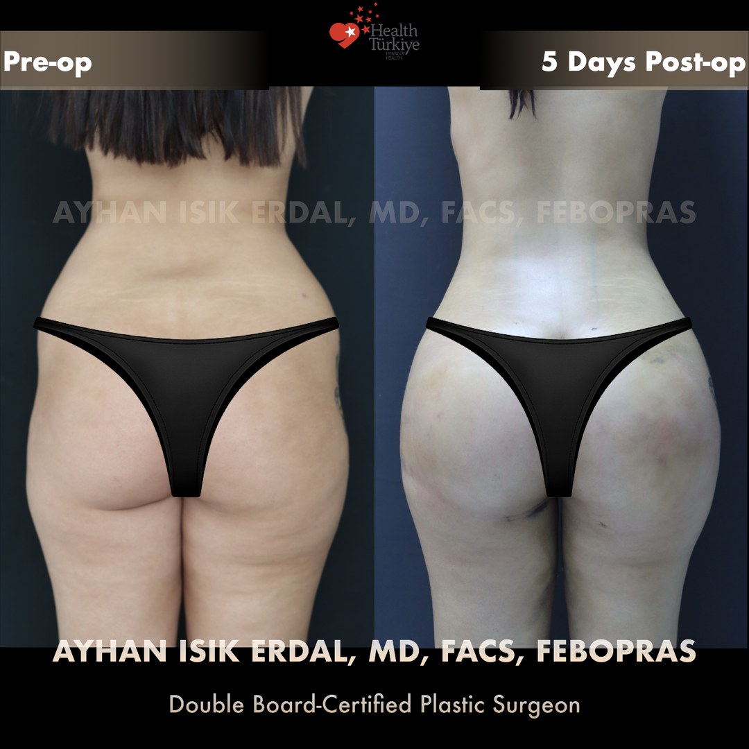 Patient case 1, view 2 — pre-op vs post-op comparison, watermarked with surgeon credentials