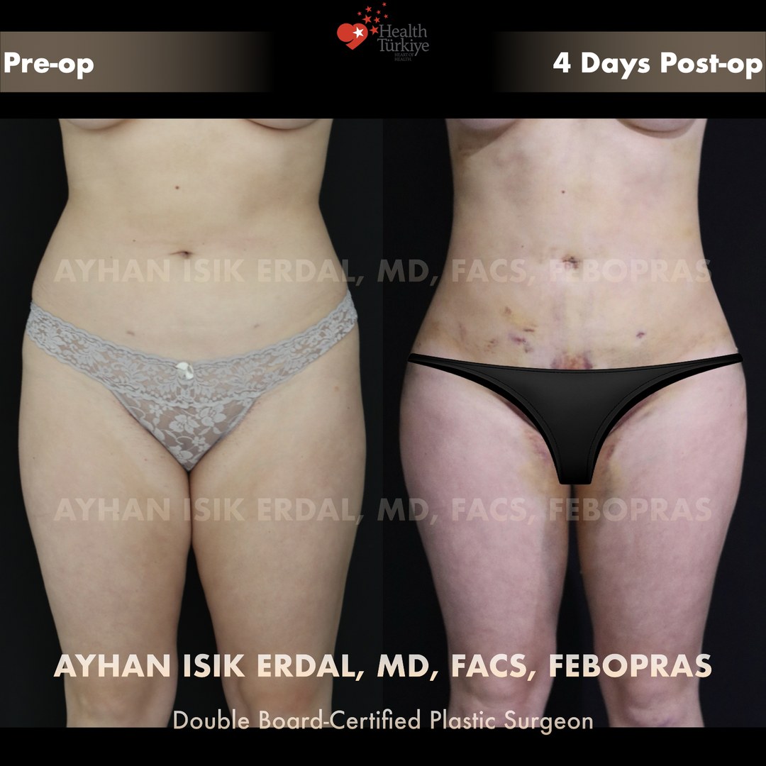 Patient case 2, view 1 — pre-op vs post-op comparison, watermarked with surgeon credentials