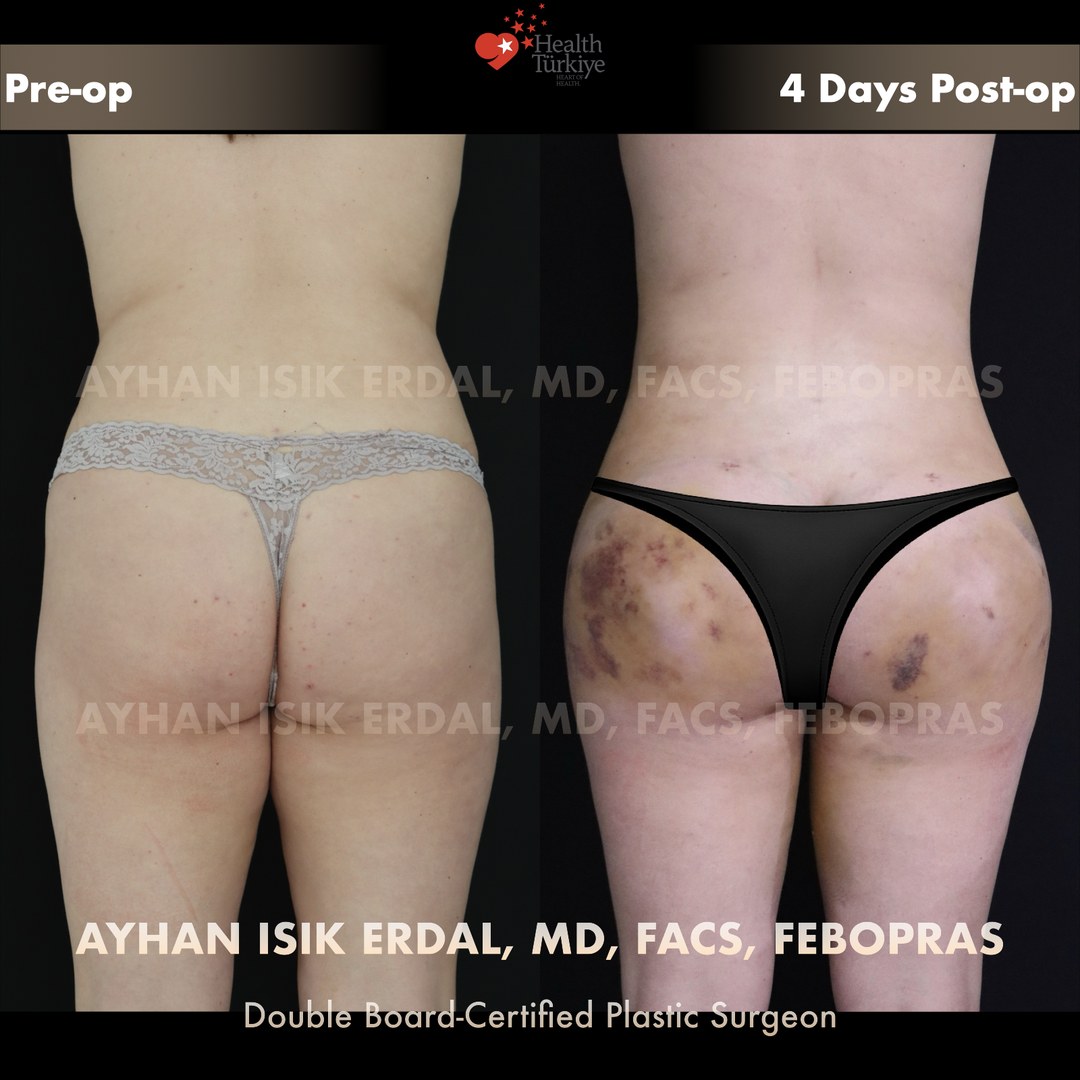 Patient case 2, view 2 — pre-op vs post-op comparison, watermarked with surgeon credentials