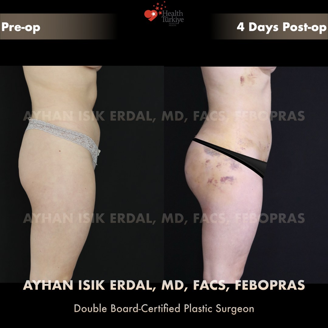 Patient case 2, view 3 — pre-op vs post-op comparison, watermarked with surgeon credentials