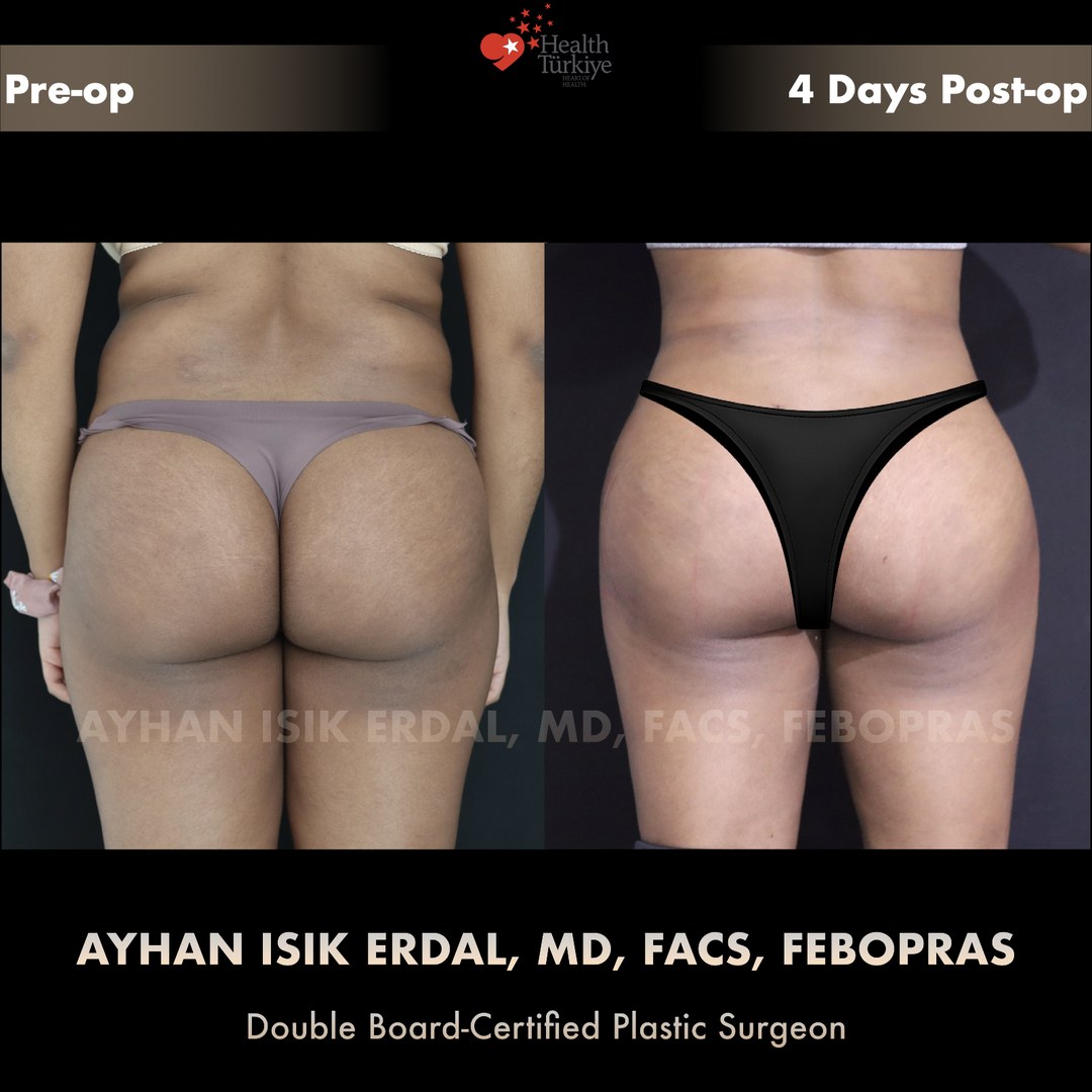 Patient case 3, view 1 — pre-op vs post-op comparison, watermarked with surgeon credentials