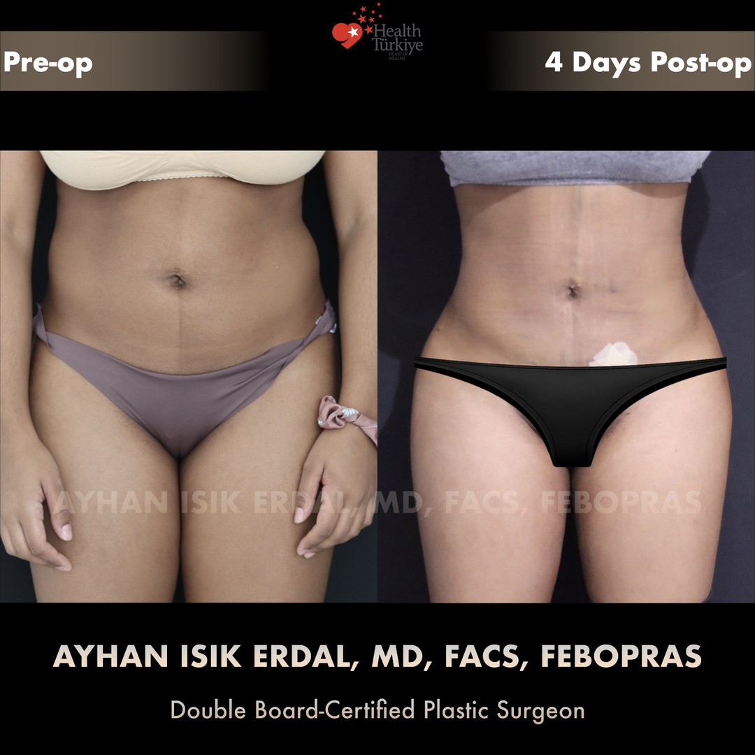 Patient case 3, view 2 — pre-op vs post-op comparison, watermarked with surgeon credentials