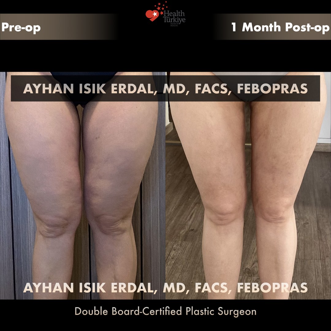 Patient case 4, view 1 — pre-op vs post-op comparison, watermarked with surgeon credentials