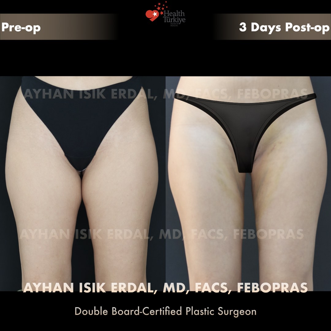 Patient case 5, view 1 — pre-op vs post-op comparison, watermarked with surgeon credentials