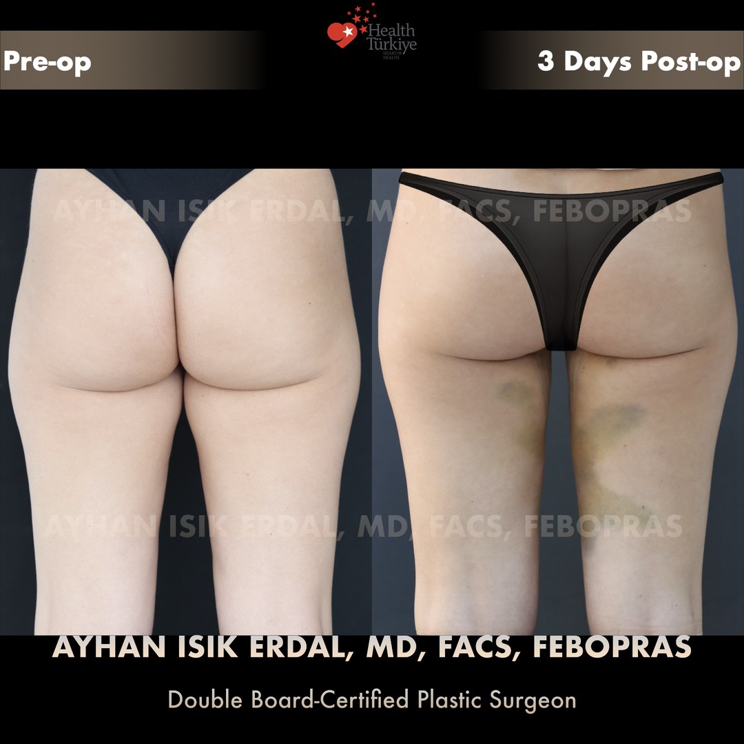 Patient case 5, view 2 — pre-op vs post-op comparison, watermarked with surgeon credentials