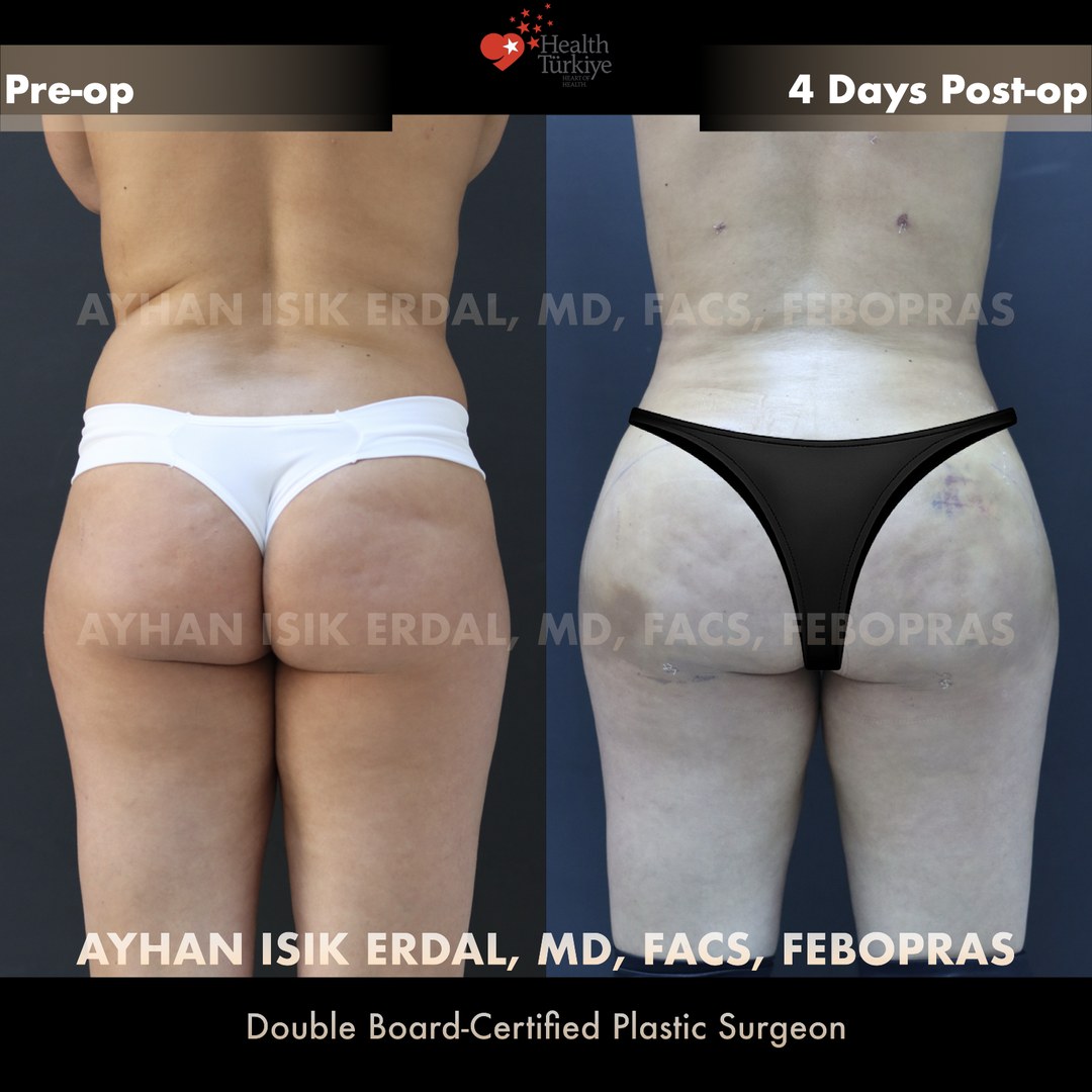 Patient case 6, view 1 — pre-op vs post-op comparison, watermarked with surgeon credentials