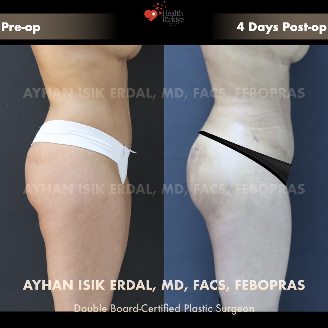 Patient case 6, view 2 — pre-op vs post-op comparison, watermarked with surgeon credentials