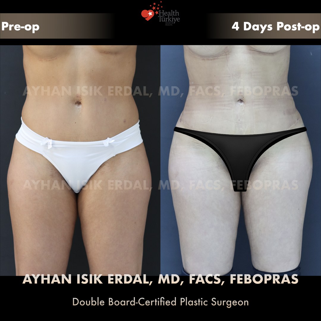 Patient case 6, view 3 — pre-op vs post-op comparison, watermarked with surgeon credentials