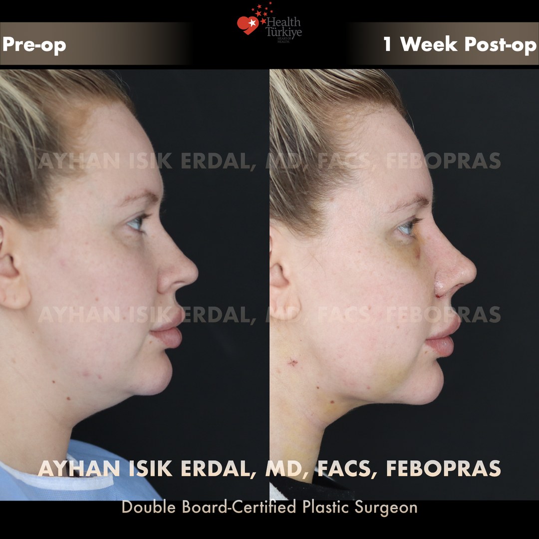 Patient case 7, view 1 — pre-op vs post-op comparison, watermarked with surgeon credentials