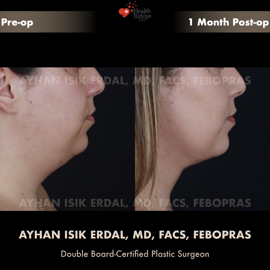 Patient case 8, view 1 — pre-op vs post-op comparison, watermarked with surgeon credentials