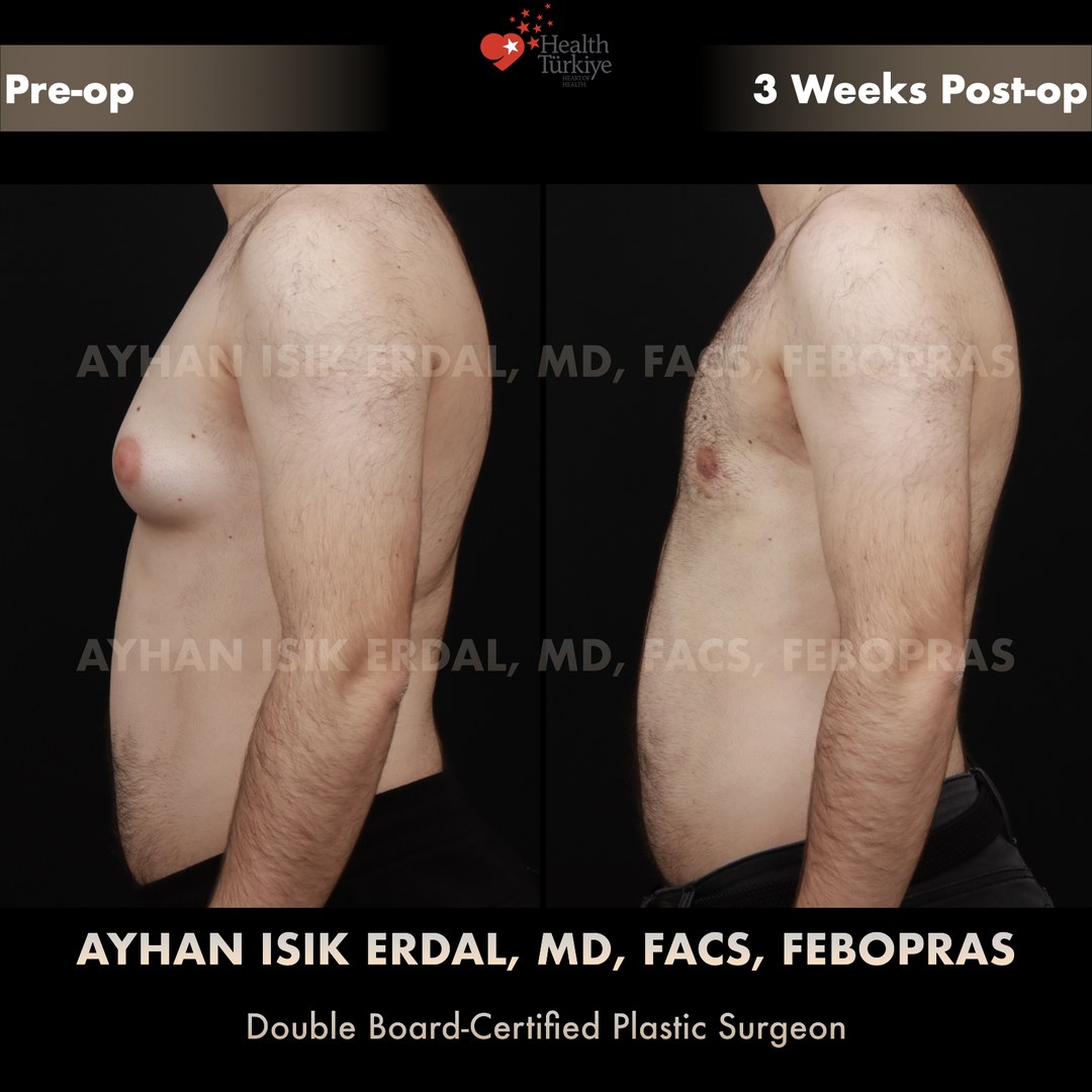 Patient case 9, view 1 — pre-op vs post-op comparison, watermarked with surgeon credentials