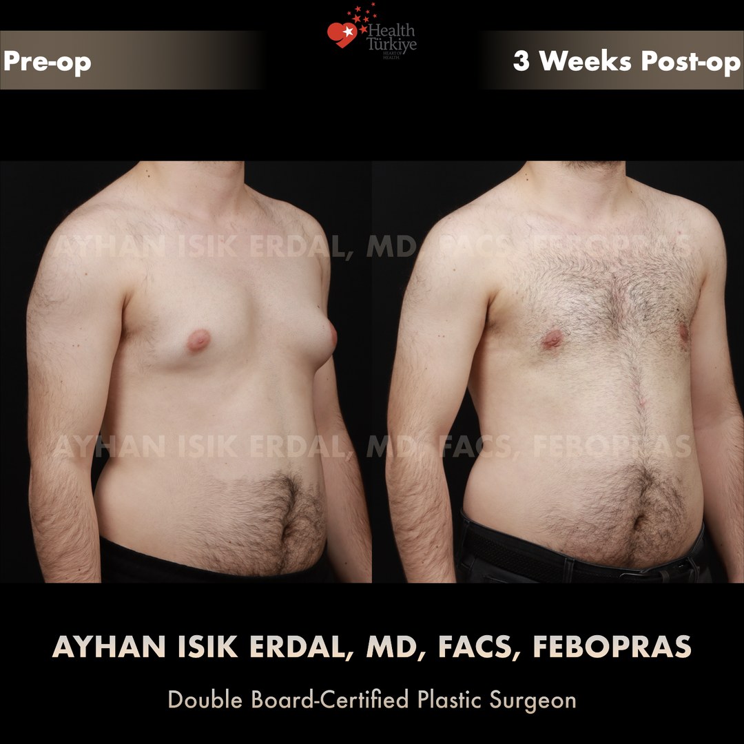 Patient case 9, view 2 — pre-op vs post-op comparison, watermarked with surgeon credentials