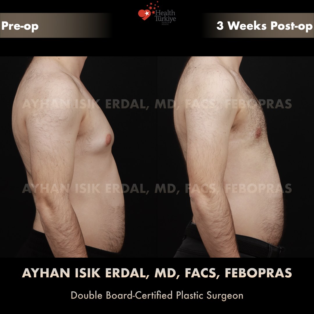 Patient case 9, view 3 — pre-op vs post-op comparison, watermarked with surgeon credentials